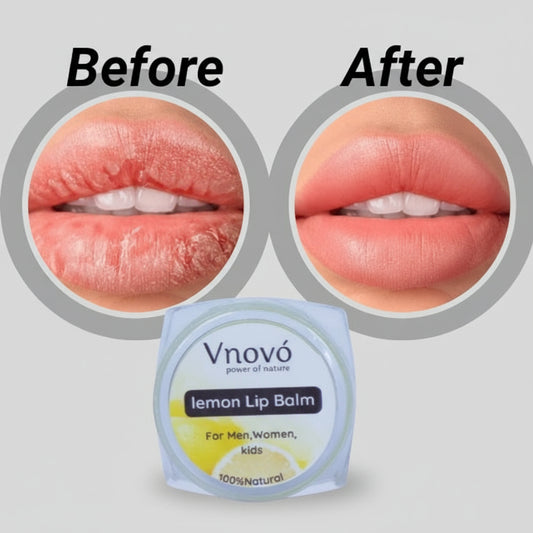 Lemon Lip Balm
