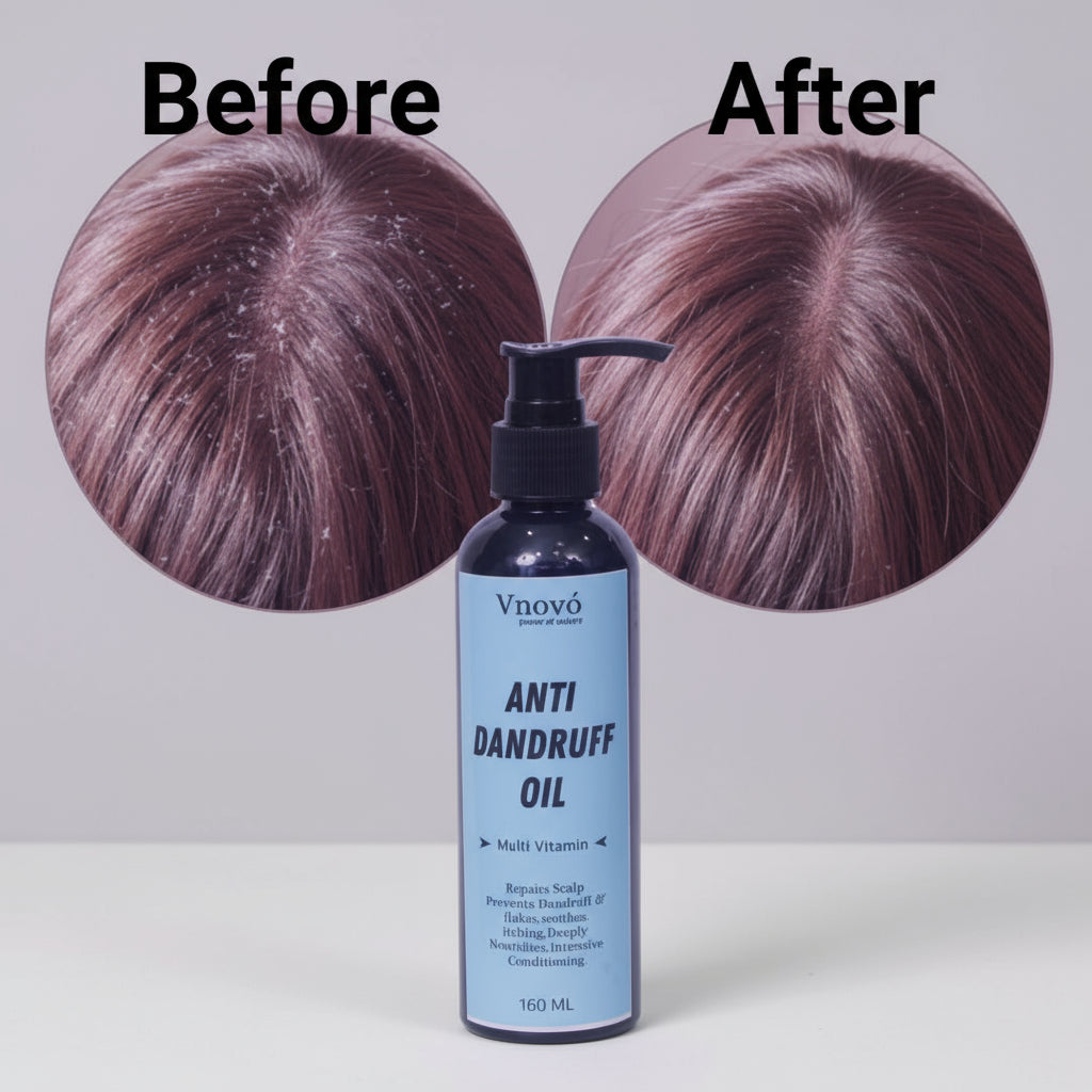 Anti Dandruff Oil