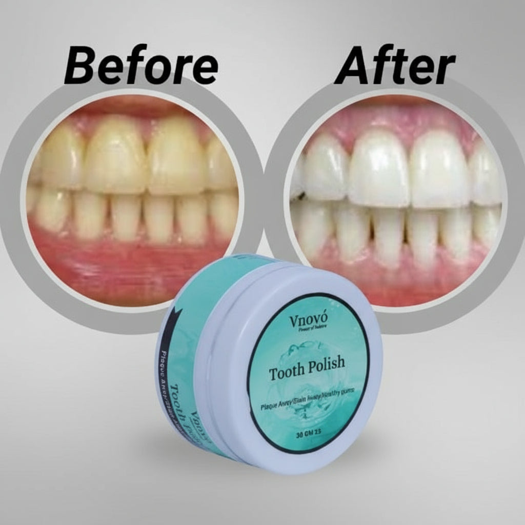 Tooth Polish